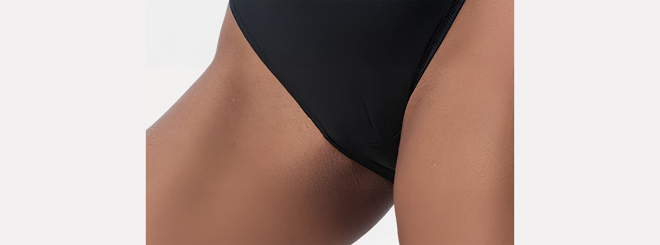 Close up of a woman's bikini line after receiving laser hair removal.