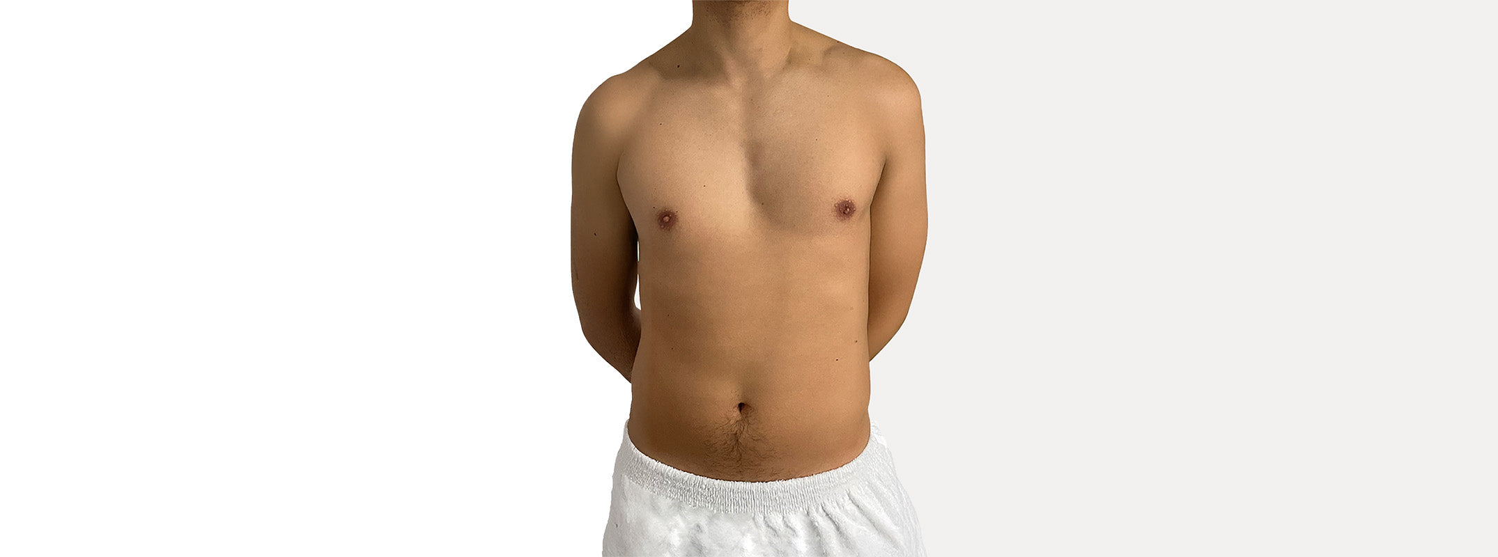 A man's chest before receiving a muscle toning treatment.