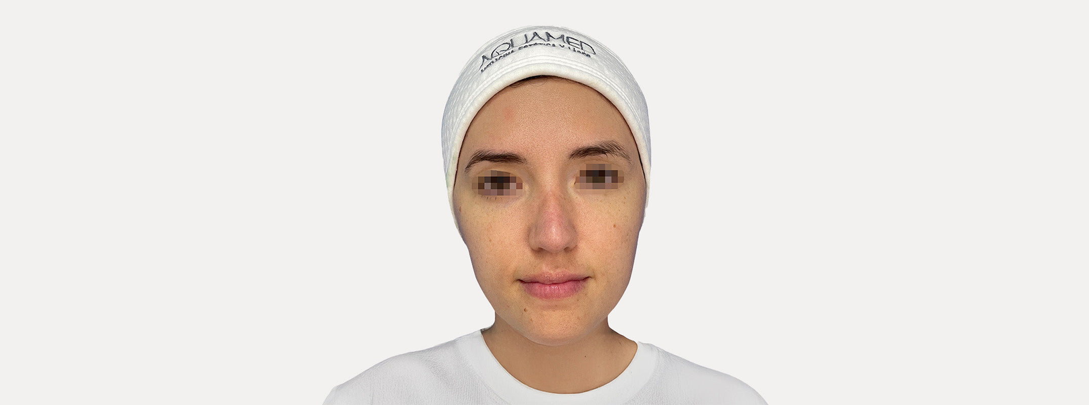 A woman's face after  receiving a green detox facial. 