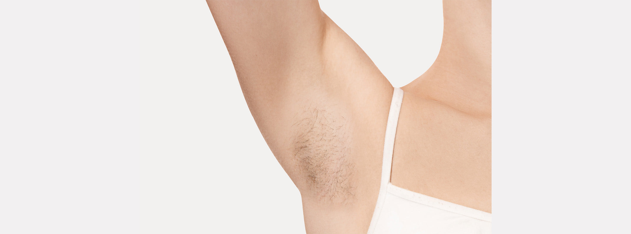 Close up of an armpit before receiving laser hair removal.