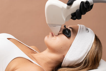 A woman receiving laser hair removal on her face.
